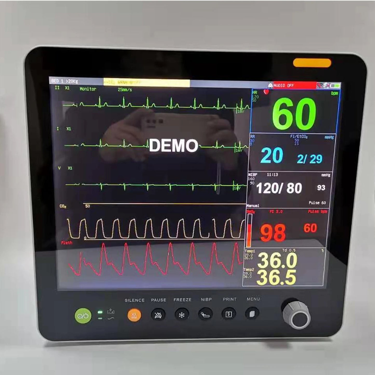 Portable Vital Signs Patient Monitor Animal Vet Multi Parameter Medical With Vet Capnograph Veterinary
