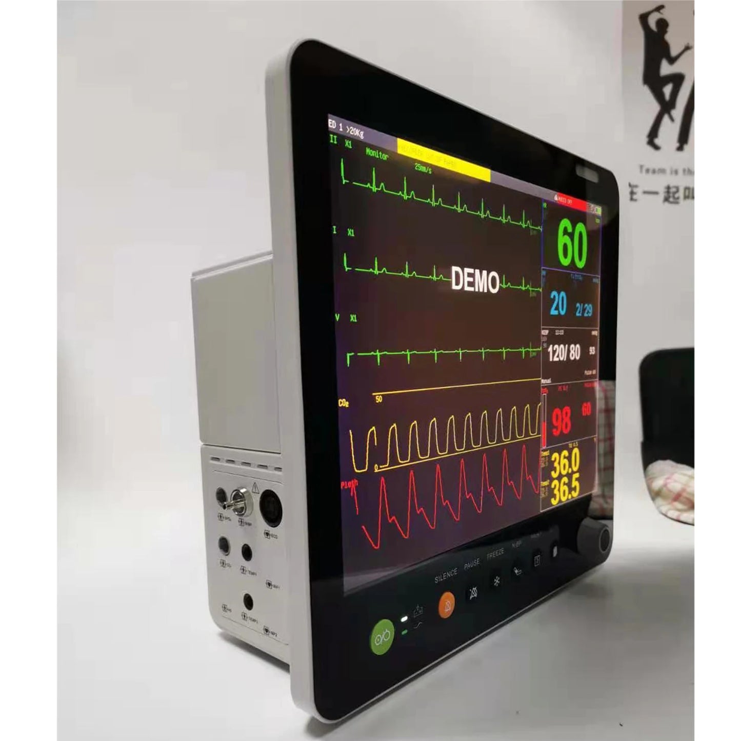 Portable Vital Signs Patient Monitor Animal Vet Multi Parameter Medical With Vet Capnograph Veterinary