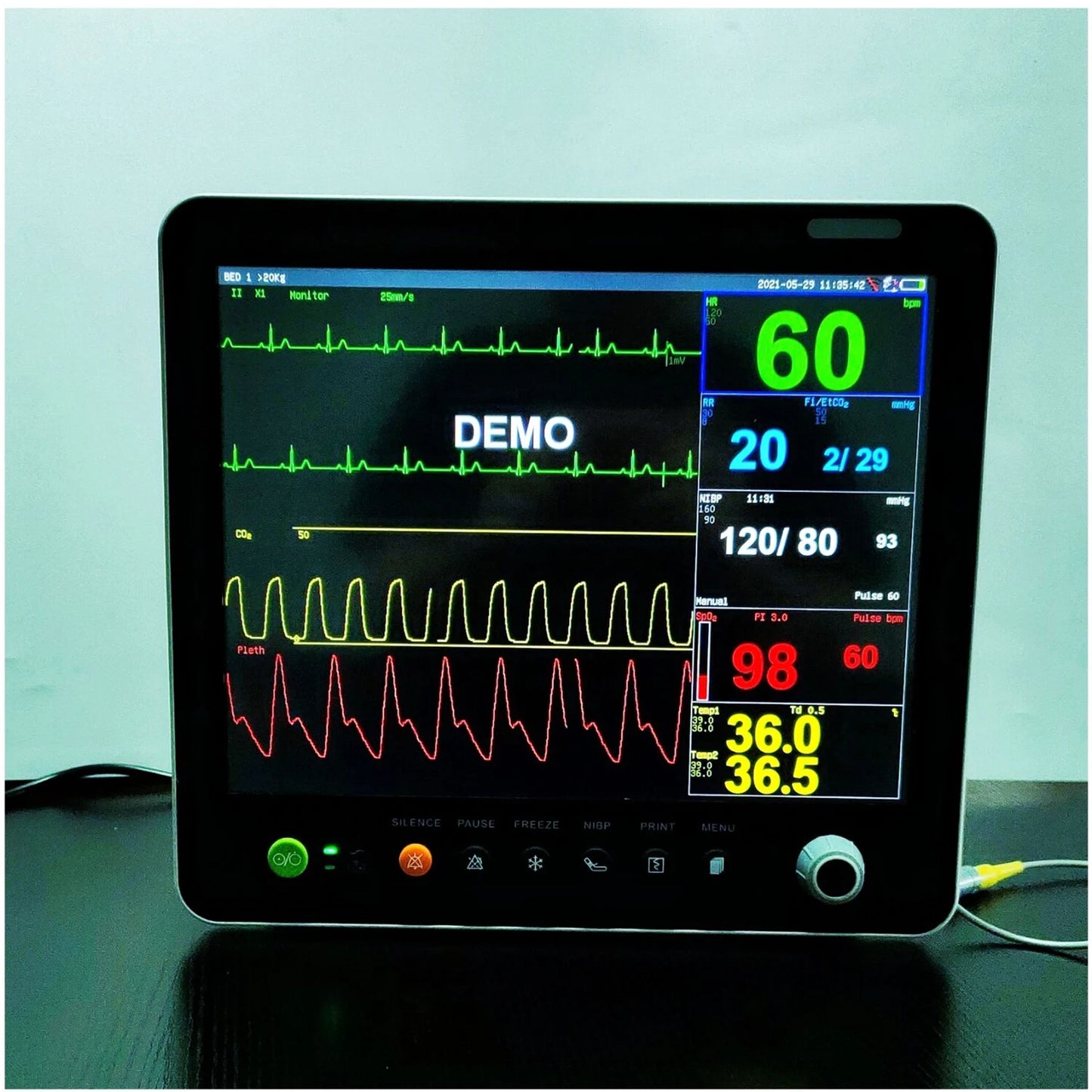 Portable Vital Signs Patient Monitor Animal Vet Multi Parameter Medical With Vet Capnograph Veterinary